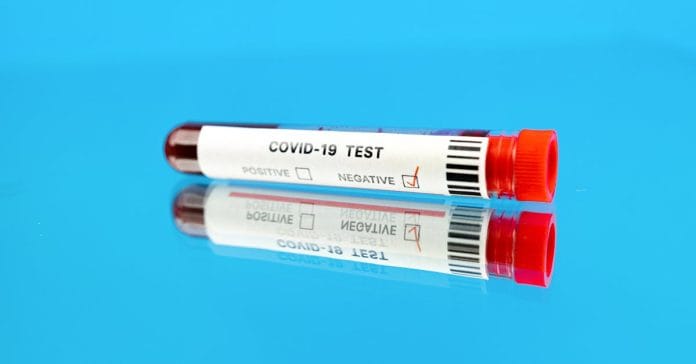 Reynmen'in Yeniden Yaptırdığı Uyuşturucu Testi Sonucu Açıklandı