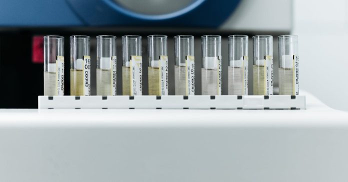 Ünlü Şefin Uyuşturucu Testi: Sonuçlar Ne Diyor?
